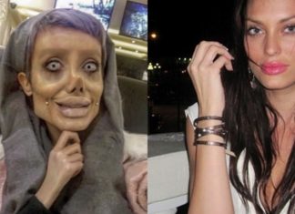 22-летняя иранка сделала 50 пластических операций, чтобы стать двойником Анджелины Джоли